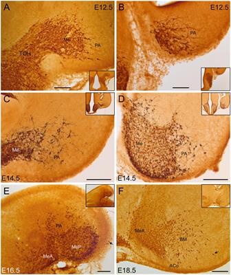 Precise Mapping of Otp Expressing Cells Across Different Pallial Regions Throughout Ontogenesis Using Otp-Specific Reporter Transgenic Mice